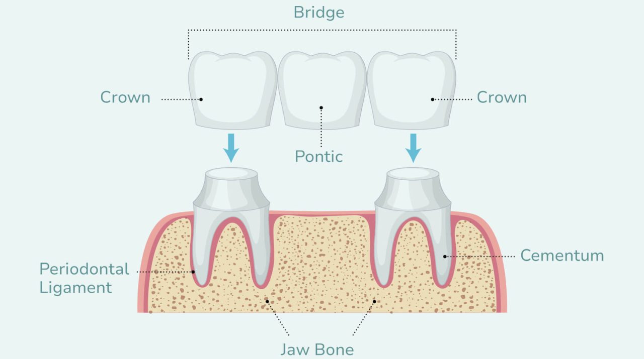 Restorative - The Orthodontic Clinic